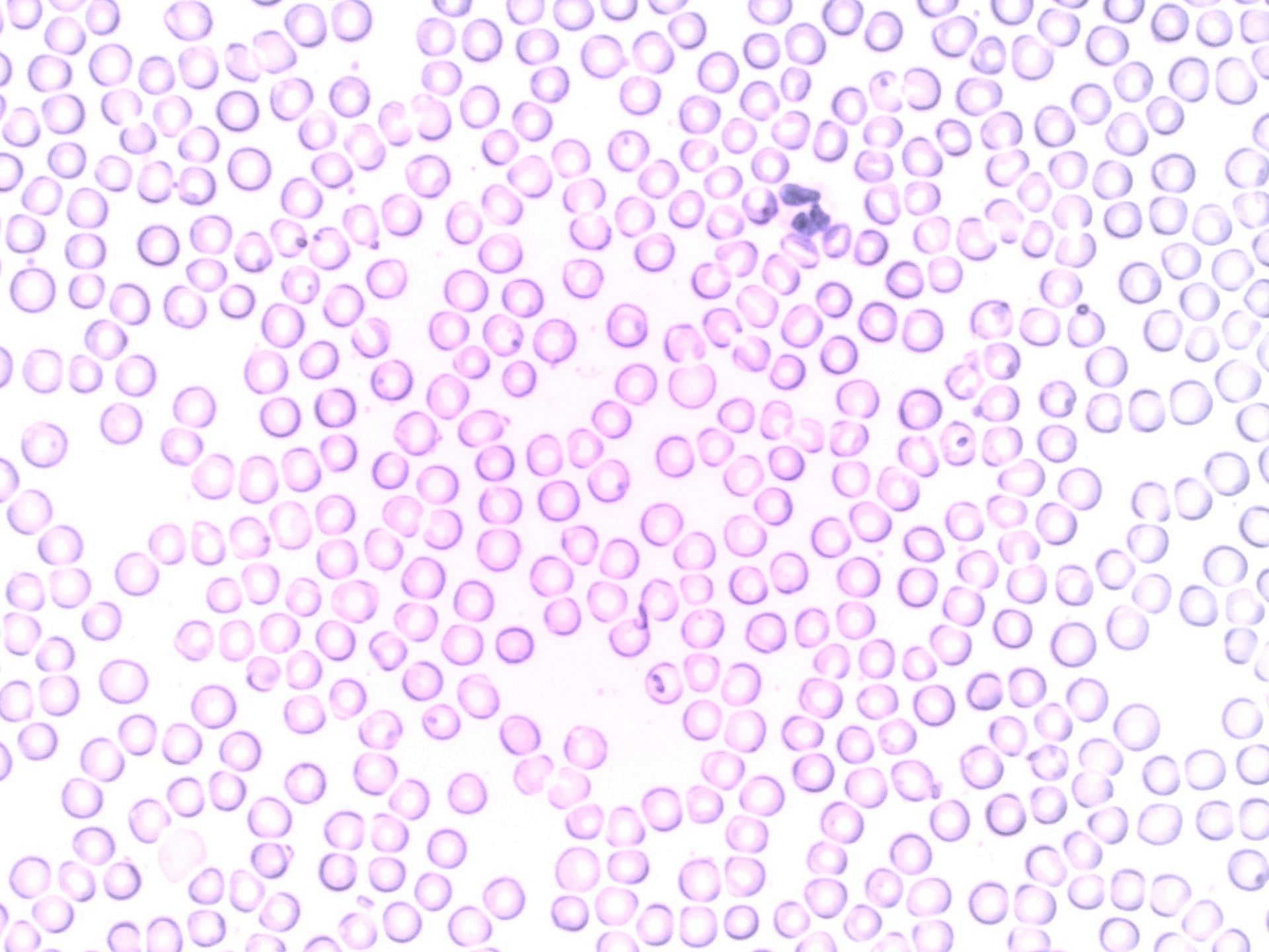 Dietary Changes to Increase White Blood Cell Count (Image via Pexels)